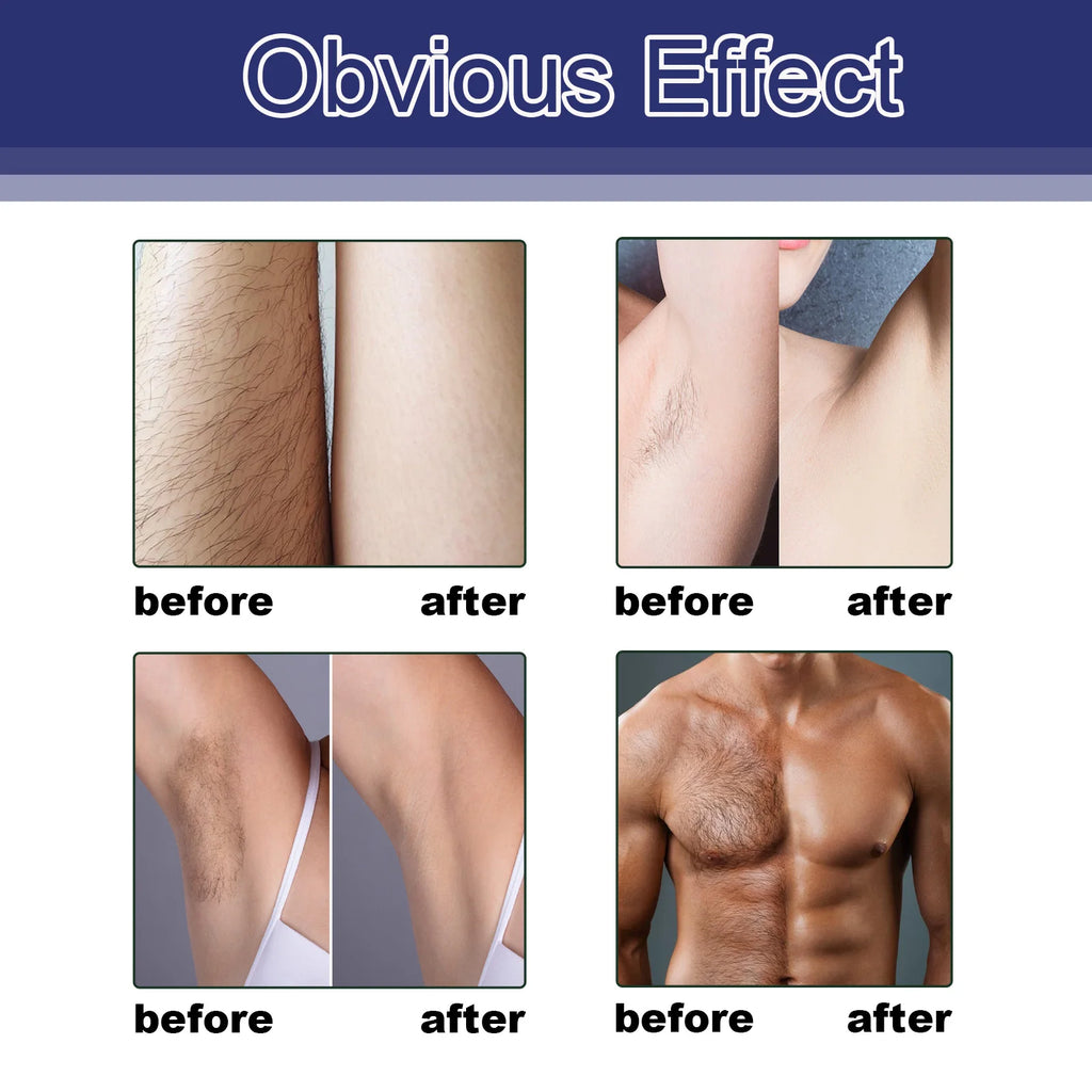Permanent Hair Growth Inhibitor & Hair Removal Spray for  Arm, Leg & Armpit, Painless Quick Hair Removal Spray for Women & Men